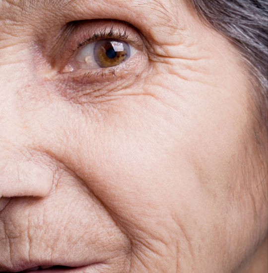 Face of an older person with open eye looking down the camera